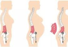 Đông y điều trị hiệu quả đau thắt Lưng sau sinh