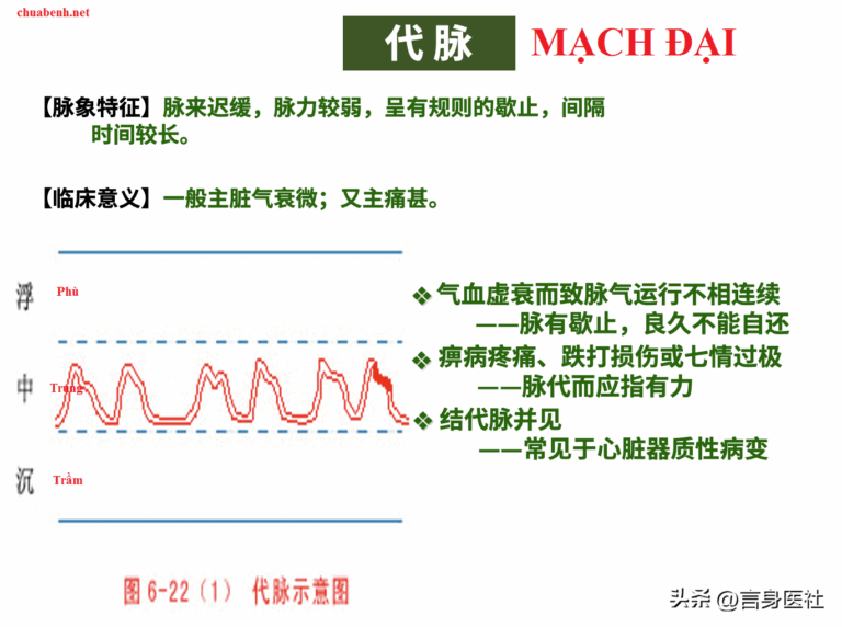 Mạch Đợi (đại)