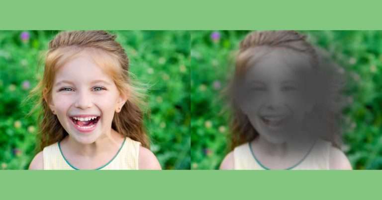 Cơ chế bệnh của thoái hóa Hoàng Điểm là gì?