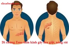 Bị Di Chứng Zona Thần Kinh