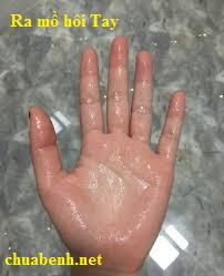Ra mồ hôi Tay