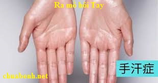 Ra mồ hôi Tay