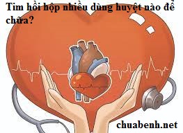 Tim hồi hộp nhiều dùng huyệt nào để chữa?