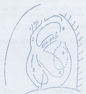 tu-the-chech