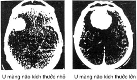 u-mang-nao-tren-cat-lop