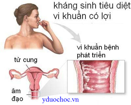 viem-nhiem-sinh-duc-nu