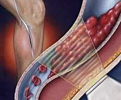 viem-tac-dong-mach-241×200